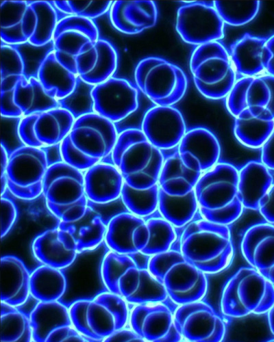 Análisis de Sangre en Campo Obscuro